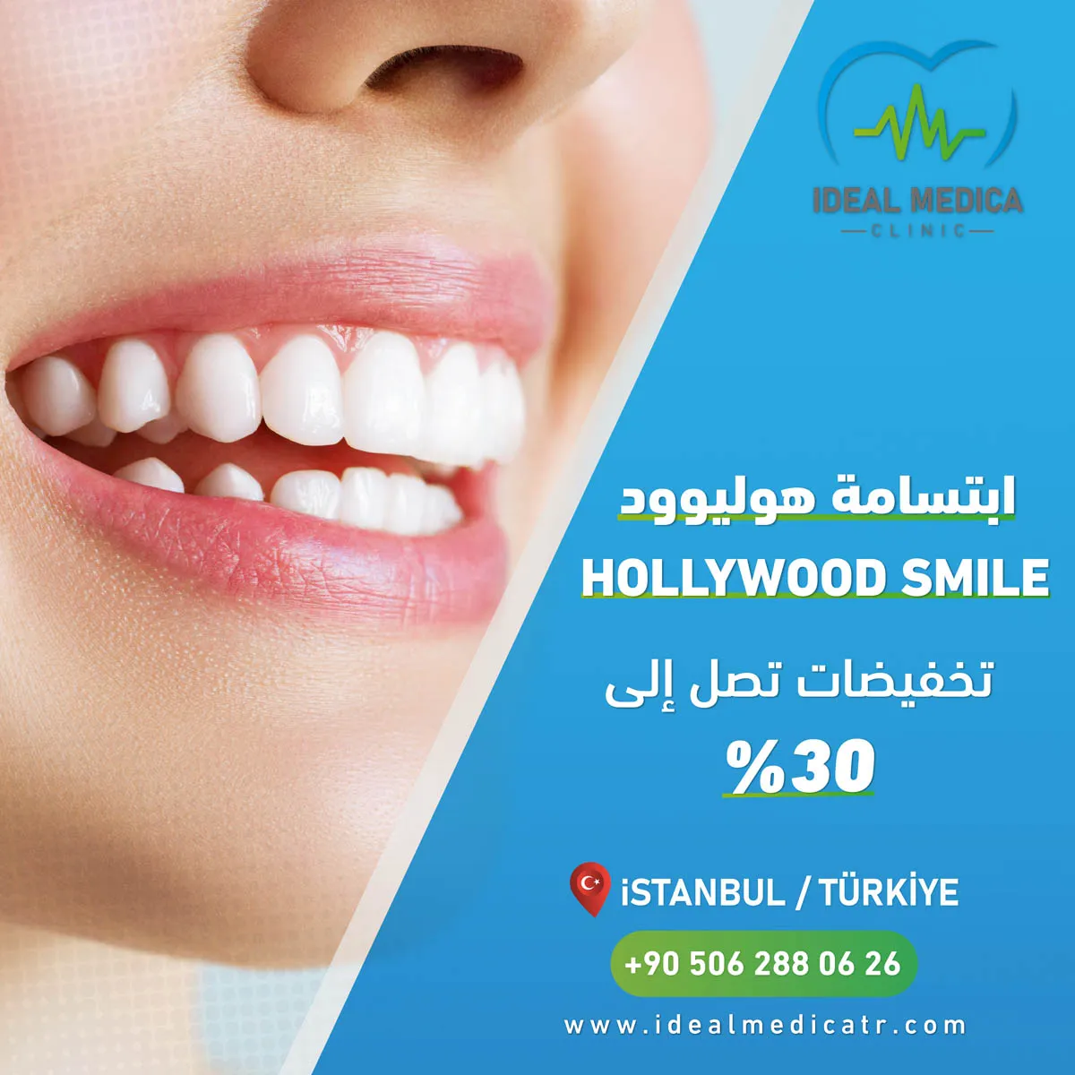 ابتسامة-هوليود-01